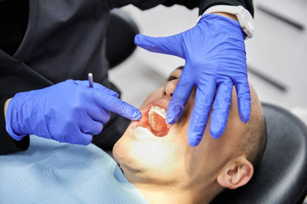 Best Emergency Tooth Extraction in Meridian Hills, IN