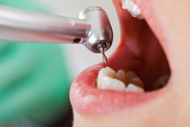 Best Emergency Treatment for Dental Infections or Abscesses in Meridian Hills, IN